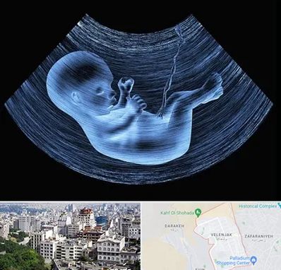 دکتر متخصص غربال گری در ولنجک 