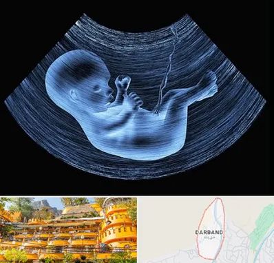 دکتر متخصص غربال گری در دربند