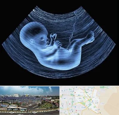 دکتر متخصص غربال گری در منطقه 15 تهران