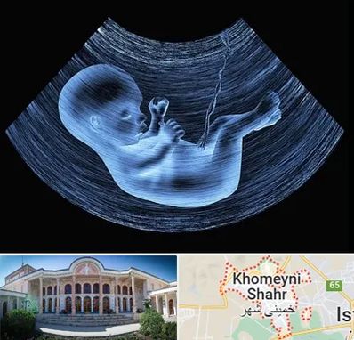 دکتر متخصص غربال گری در خمینی شهر