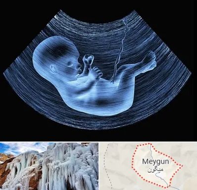 دکتر متخصص غربال گری در میگون