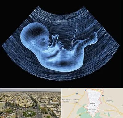 دکتر متخصص غربال گری در قزوین