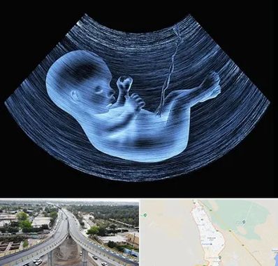 دکتر متخصص غربال گری در اندیمشک