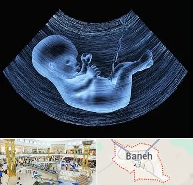 دکتر متخصص غربال گری در بانه