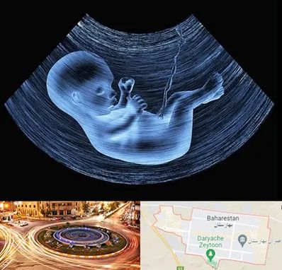 دکتر متخصص غربال گری در بهارستان