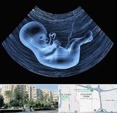 دکتر متخصص غربال گری در آپادانا