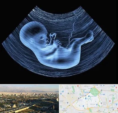 دکتر متخصص غربال گری در منطقه 19 تهران