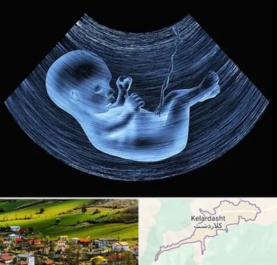 دکتر متخصص غربال گری در کلاردشت