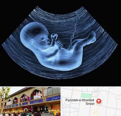 دکتر متخصص غربال گری در 15 خرداد