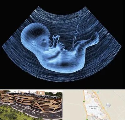 دکتر متخصص غربال گری در شاهین شهر