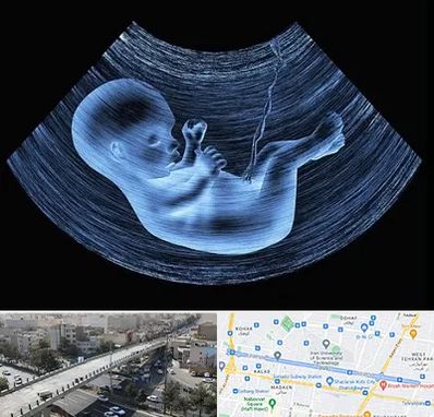 دکتر متخصص غربال گری در فرجام