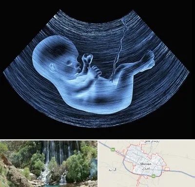 دکتر متخصص غربال گری در شیروان