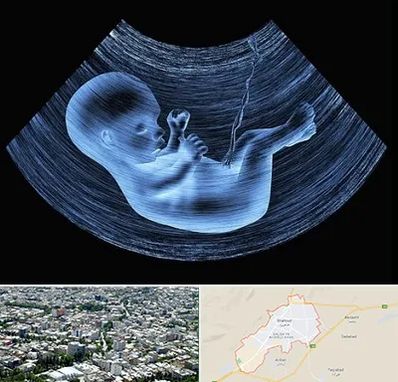 دکتر متخصص غربال گری در شاهرود