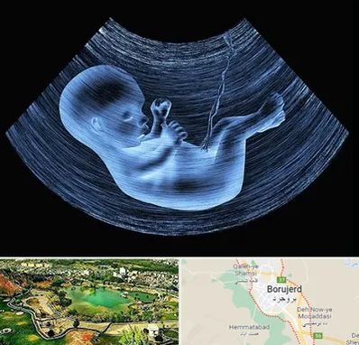 دکتر متخصص غربال گری در بروجرد