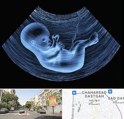 دکتر متخصص غربال گری در چهارصد دستگاه 