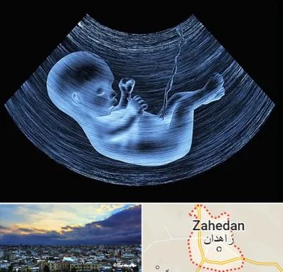 دکتر متخصص غربال گری در زاهدان