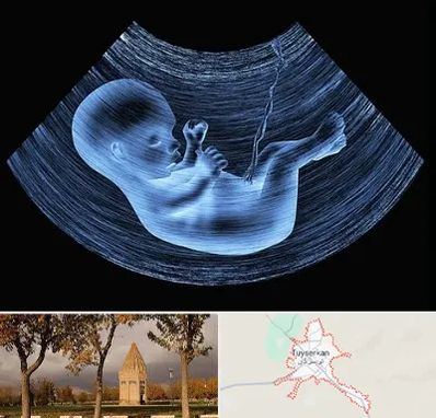 دکتر متخصص غربال گری در تویسرکان