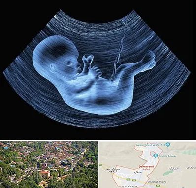 دکتر متخصص غربال گری در دماوند