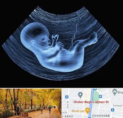 دکتر متخصص غربال گری در چهارباغ اصفهان