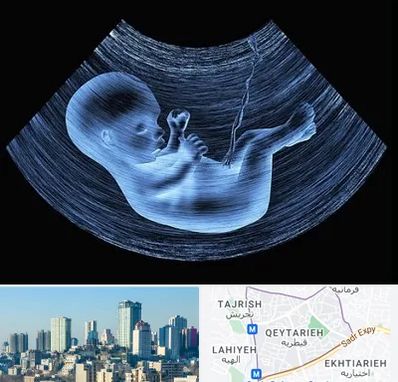 دکتر متخصص غربال گری در قیطریه 