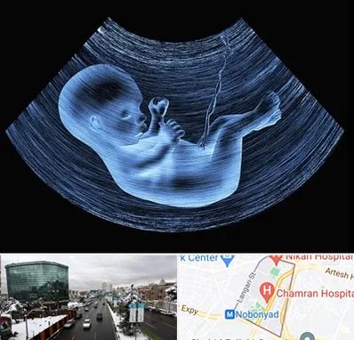 دکتر متخصص غربال گری در اقدسیه 