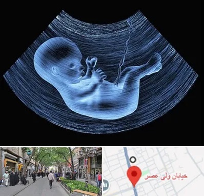 دکتر متخصص غربال گری در ولیعصر شهریار