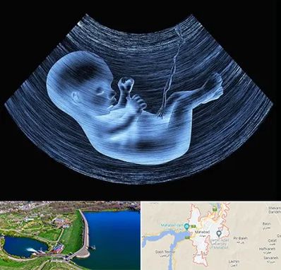 دکتر متخصص غربال گری در مهاباد