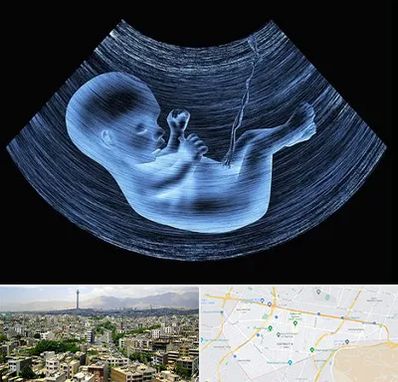 دکتر متخصص غربال گری در منطقه 8 تهران