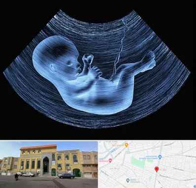 دکتر متخصص غربال گری در زنبیل آباد قم