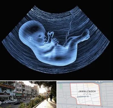 دکتر متخصص غربال گری در خیابان جمالزاده