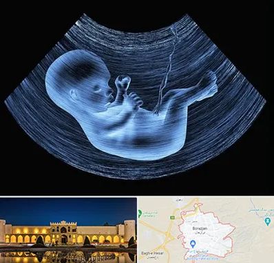 دکتر متخصص غربال گری در برازجان