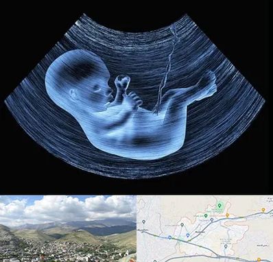 دکتر متخصص غربال گری در رودهن