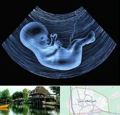 دکتر متخصص غربال گری در صومعه سرا