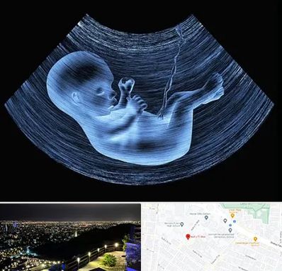 دکتر متخصص غربال گری در هفت تیر مشهد