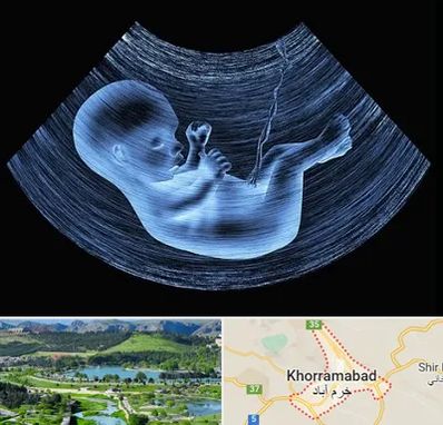 دکتر متخصص غربال گری در خرم آباد