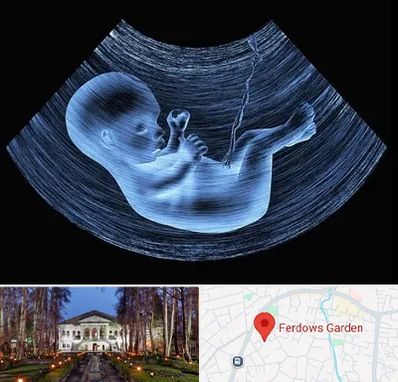 دکتر متخصص غربال گری در باغ فردوس