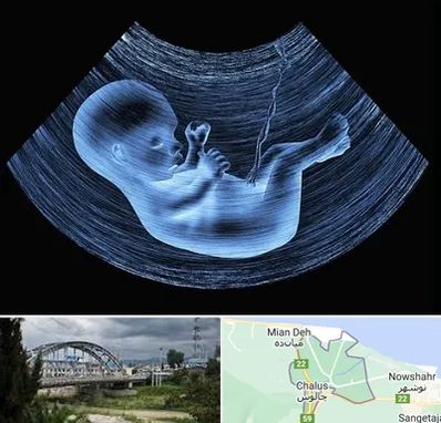 دکتر متخصص غربال گری در چالوس