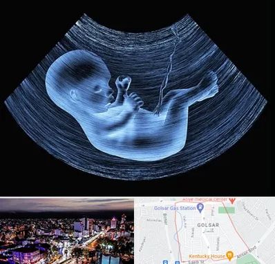 دکتر متخصص غربال گری در گلسار رشت 