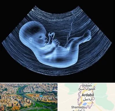 دکتر متخصص غربال گری در اردبیل