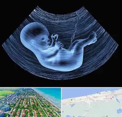 دکتر متخصص غربال گری در فریدونکنار