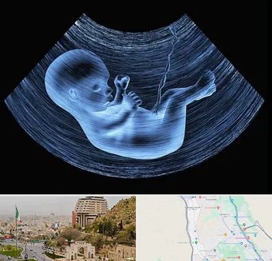 دکتر متخصص غربال گری در فرهنگ شهر شیراز