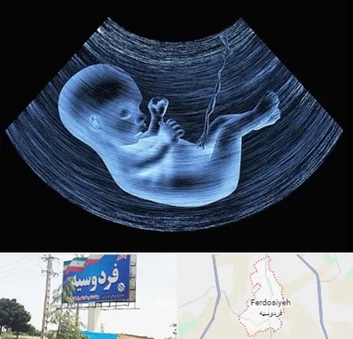 دکتر متخصص غربال گری در فردوسیه شهریار
