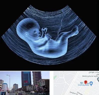 دکتر متخصص غربال گری در چهارراه طالقانی کرج