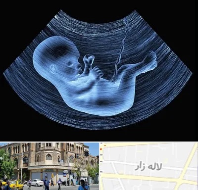 دکتر متخصص غربال گری در لاله زار