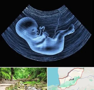 دکتر متخصص غربال گری در گلستان
