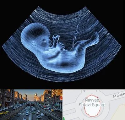 دکتر متخصص غربال گری در نواب