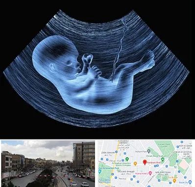 دکتر متخصص غربال گری در بلوار فردوسی مشهد