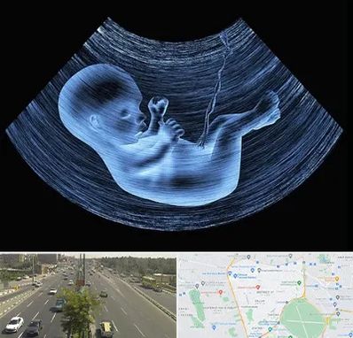 دکتر متخصص غربال گری در منطقه 17 تهران