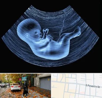 دکتر متخصص غربال گری در خیابان فلسطین