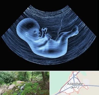 دکتر متخصص غربال گری در آزادشهر